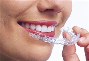 Şeffaf Plaklar (İnvisalign)